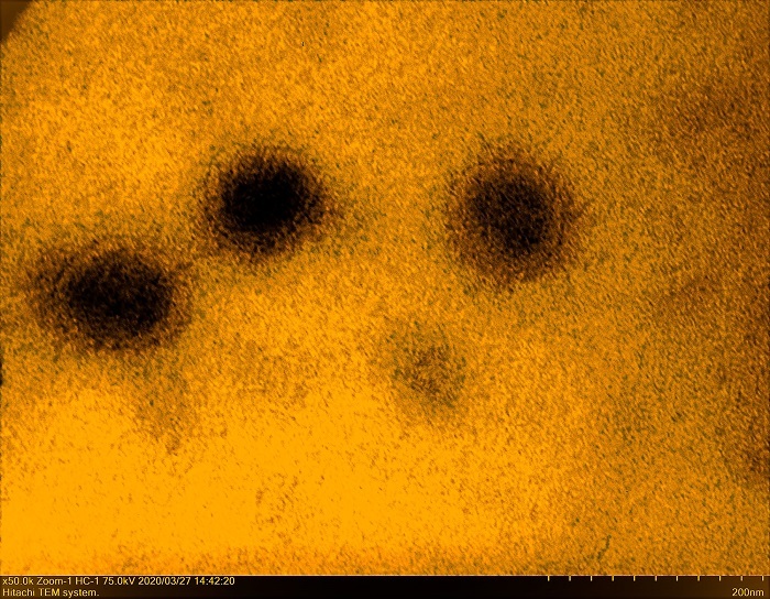 圖為研究團隊在電子顯微鏡下取得的新冠病毒顯微影像。